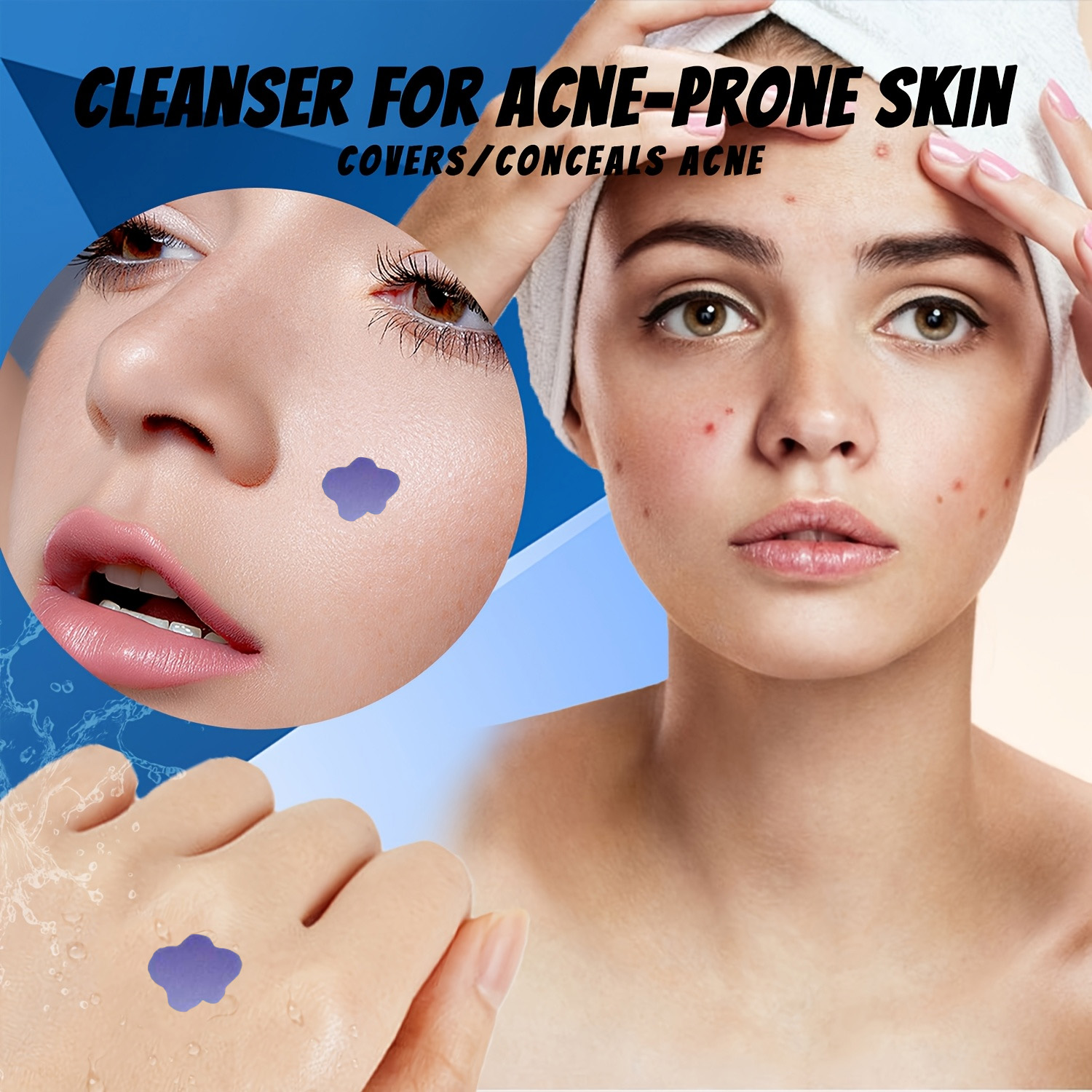 Cerotti Microneedle per Acne e - Skincare Acne recensione e prezzo