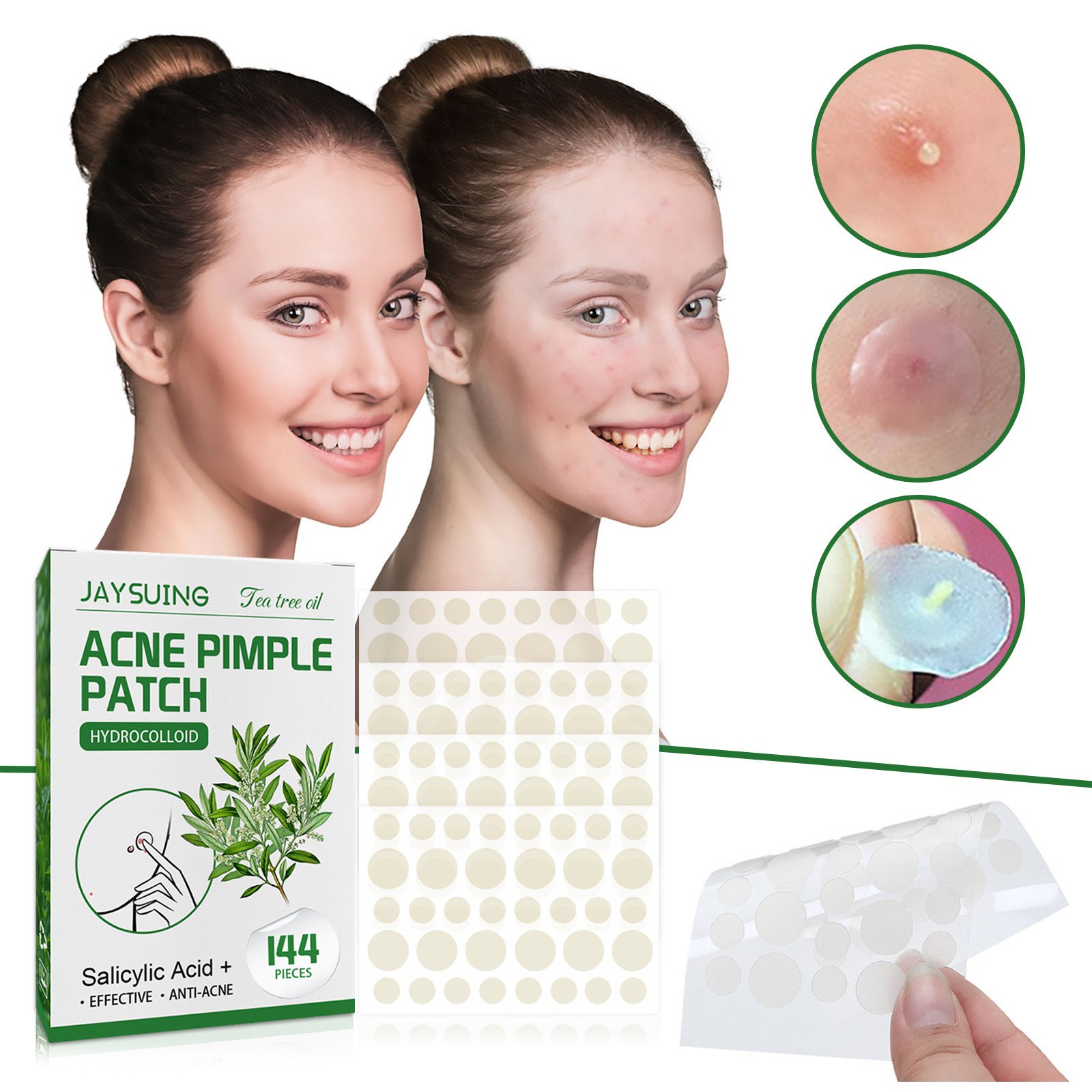 Cerotti idrocolidi per l'acne: - Hydrocolloid Acne Patch recensione e prezzo